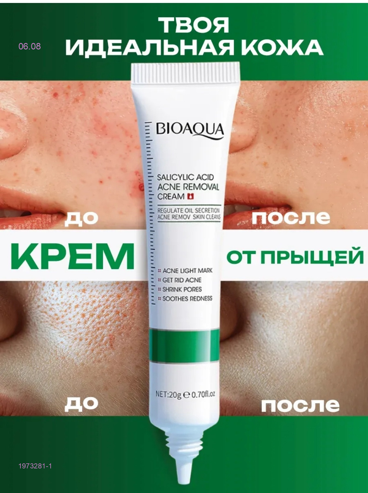 Крем от прыщей 1973281-1