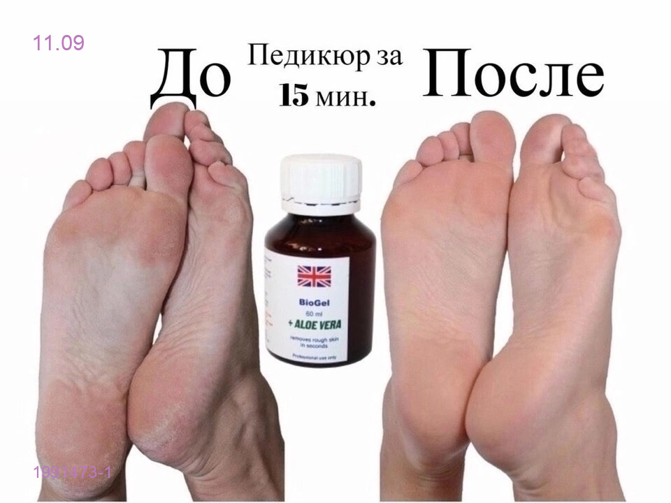 Ремувер biogel + 1991473-1