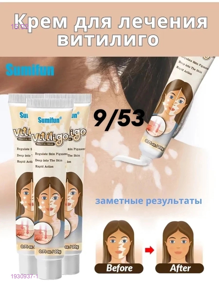Крем против витилиго 1930937-1